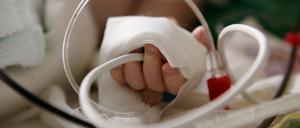 Die Intensivstationen für Kinder sind schon jetzt fast voll ausgelastet.