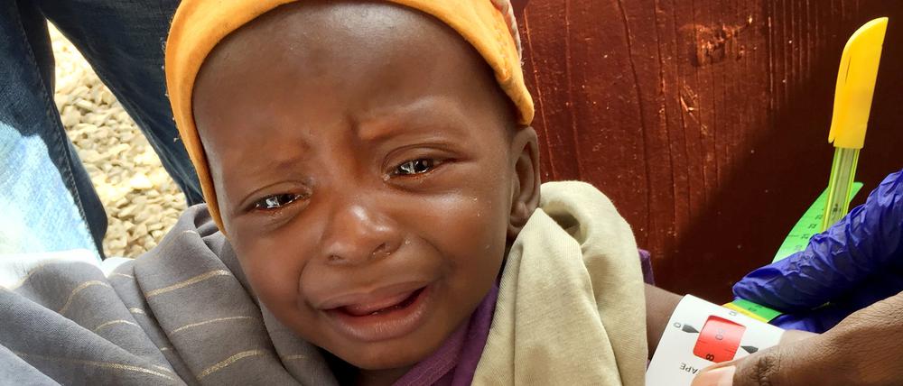 Somalia, einer der Hotspots bitterer Not, hier im Sommer dieses Jahres: Rachid, ein schwer unterernährtes Baby, wird in einer Klinik vermessen. 