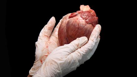 700 Menschen stehen in Deutschland auf der Transplantationsliste für ein Spenderherz. Doppelt so viele bräuchten wahrscheinlich eins.