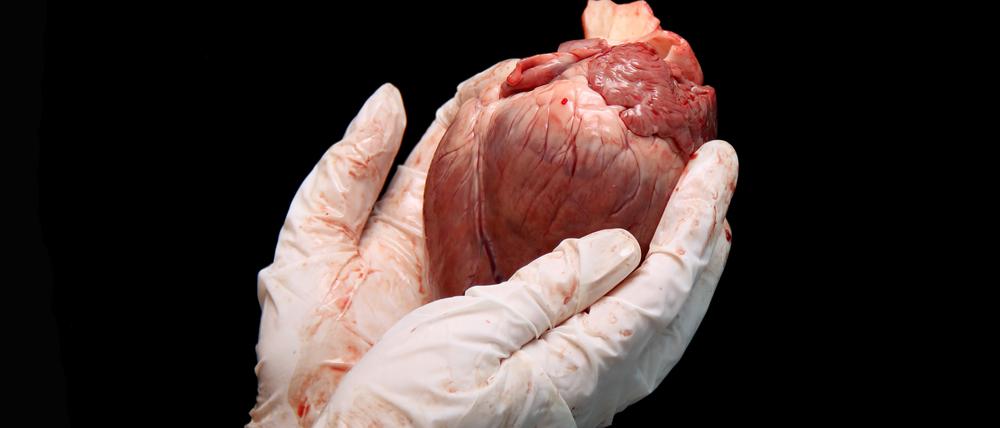 700 Menschen stehen in Deutschland auf der Transplantationsliste für ein Spenderherz. Doppelt so viele bräuchten wahrscheinlich eins.