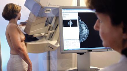 Bei Frauen zwischen 50 und 69 Jahren gilt die Mammographie als effektivste Methode zur Früherkennung von Brustkrebs.