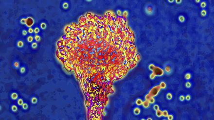 Pilze mögen es warm und feucht. An Orten wie Schwimmbädern, öffentlichen Dusch- und Waschräumen, Umkleidekabinen oder Saunen ist die Ansteckungsgefahr besonders groß.
