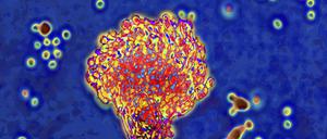 Pilze mögen es warm und feucht. An Orten wie Schwimmbädern, öffentlichen Dusch- und Waschräumen, Umkleidekabinen oder Saunen ist die Ansteckungsgefahr besonders groß.