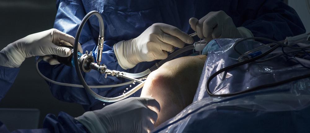 Mit einer kleinen Kamera blicken die Operateure ins Knie, um den genauen Ort und die Ausprägung des Knorpelschadens festzustellen.
