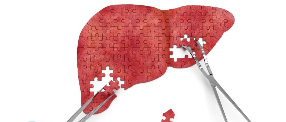 Hepatitis B kann die Leber dauerhaft schädigen.