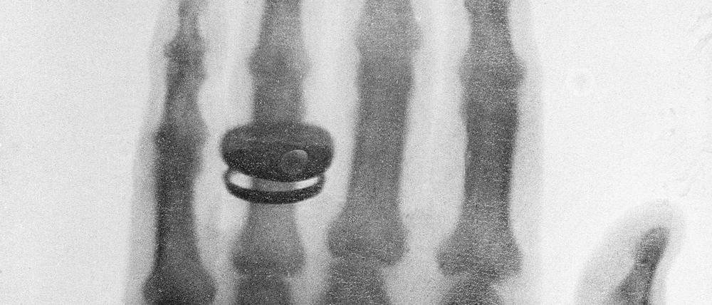 Wilhelm Konrad Röntgen bat im Dezember 1895 seine Frau Anna Bertha, ihre Hand als Testobjekt zur Verfügung zu stellen. Dabei entstand das erste dokumentierte „Röntgenbild“, das neben den Skelettknochen der Hand auch den Ehering zeigt.