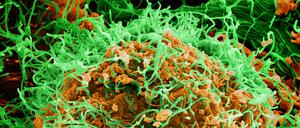 Angefärbte elektronenmikroskopische Aufnahme von Ebola-Virenkörpern, die sich von einer befallenen Zelle lösen.