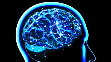 Das Hirn eines Parkinsonkranken.