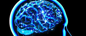 Das Hirn eines Parkinsonkranken.