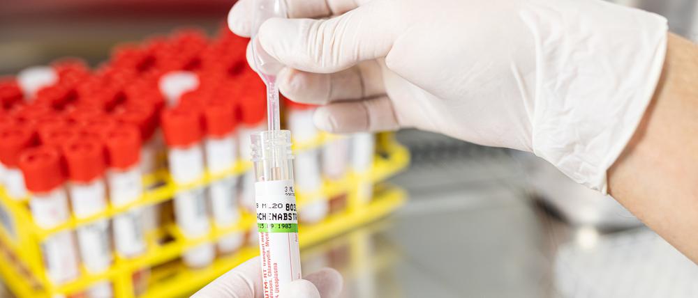 Ein Biologielaborant bereitet eine Probe von einem Rachenabstrich für einer Infektion mittels PCR vor.