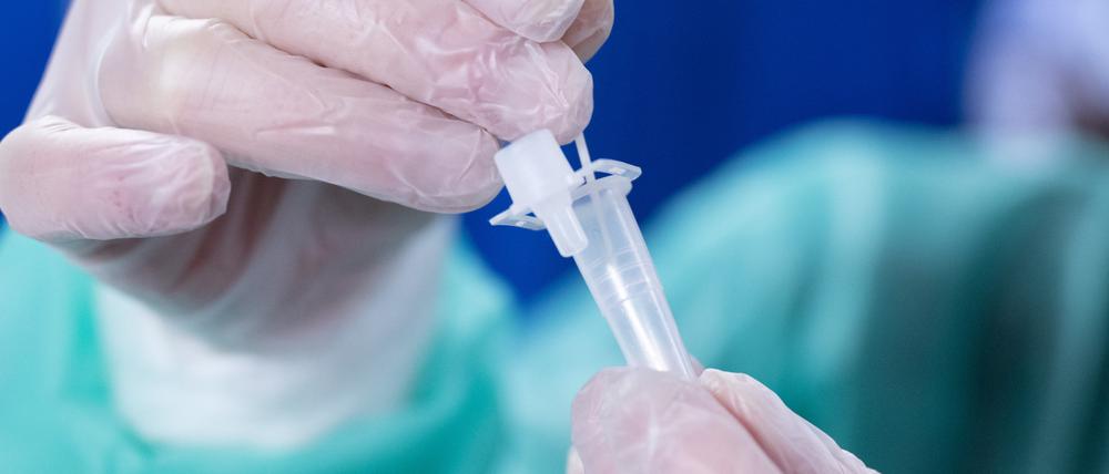 ARCHIV - 21.10.2022, Sachsen, Dresden: Eine Mitarbeiterin wertet in einem Corona-Testzentrum einen Schnelltest aus. Die Sublinie XBB.1.5 der Coronavirus-Variante Omikron ist nach WHO-Angaben auch in Europa auf dem Vormarsch. (zu dpa "WHO: Anzeichen für Ausbreitung von Corona-Variante XBB.1.5 in Europa") Foto: Sebastian Kahnert/dpa +++ dpa-Bildfunk +++