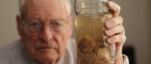 Der Pathologe Thomas Harvey Präsentiert 1994 in Kansas Einsteins Hirn in einem Glas. 