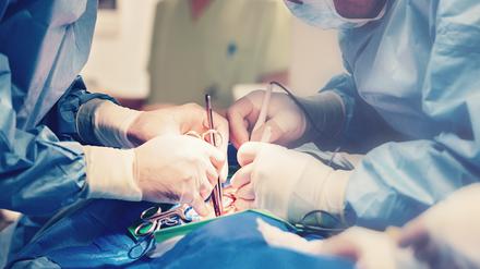 Eine minimalinvasive Krebsoperation ist immer häufiger auch bei Metastasenbildung möglich.
