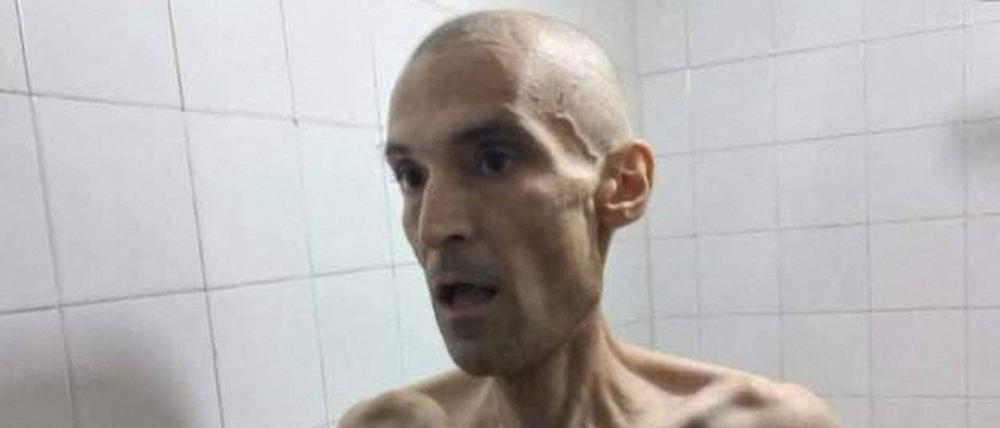 Mit rasiertem Kopf und völlig abgemagert zeigen die Bilder den 53-jährigen Arzt Farhad Meysami.