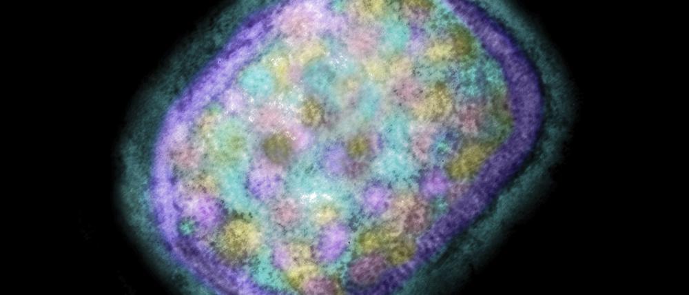 Die negativ gefärbte Transmissionselektronenmikroskopie (TEM) zeigt das ziegelsteinförmige Affenpockenvirus aus einer Zellkultur.
