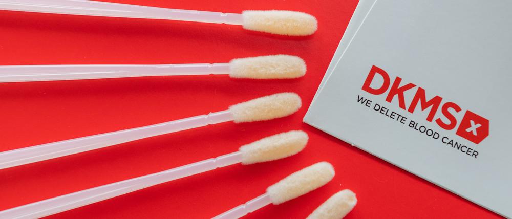Zunächst geht es nur um Zellen der Wangenschleimhaut, die mit Wattestäbchen entnommen werden.