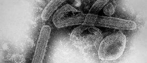 Das Elektronenmikroskop-Bild zeigt Marburg-Virus-Virionen. 