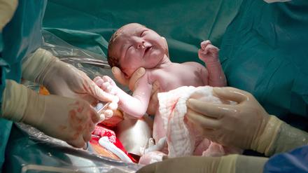 Ein Arzt hält im Kreißsaal einer Frauenklinik ein neugeborenes Baby, das per Kaiserschnitt zur Welt kam, in den Händen. 