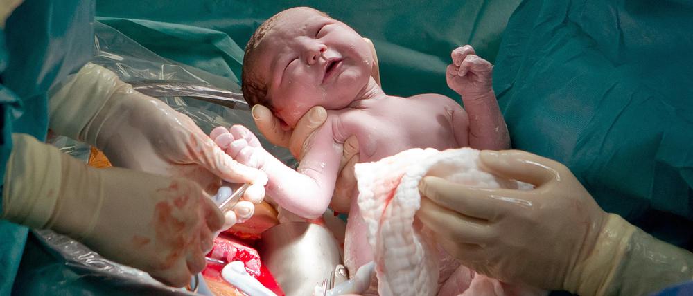 Ein Arzt hält im Kreißsaal einer Frauenklinik ein neugeborenes Baby, das per Kaiserschnitt zur Welt kam, in den Händen. 