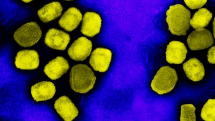 Wie genau sich der zuletzt unter Menschen verbreitete Virustyp verändert hat, ist unklar. Für Tiere ist er dadurch weniger gefährlich geworden.