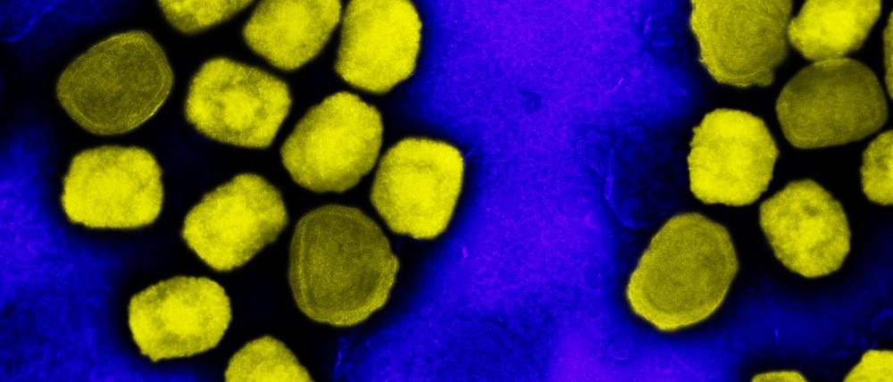 Wie genau sich der zuletzt unter Menschen verbreitete Virustyp verändert hat, ist unklar. Für Tiere ist er dadurch weniger gefährlich geworden.