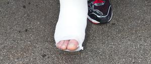 Der verletzte Fuß des Handballers Michael Haaß, aufgenommen am Donnerstag (26.01.2012) in Belgrad (Serbien) während der Abreise der deutschen Nationalmannschaft. Der Rückraumspieler vom Bundesligisten Frisch Auf Göppingen hatte sich die Verletzung am Vortag bei der 32:33-Niederlage gegen Polen einen Bruch des rechten Sprunggelenks zugezogen. Foto: Jens Wolf dpa ++ +++ dpa-Bildfunk +++