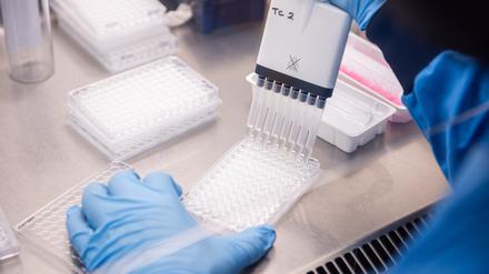 Forscher in einem Labor des Jenner-Instituts, der an dem von AstraZeneca und der Universität Oxford entwickelten Coronavirus-Impfstoff arbeitet. 