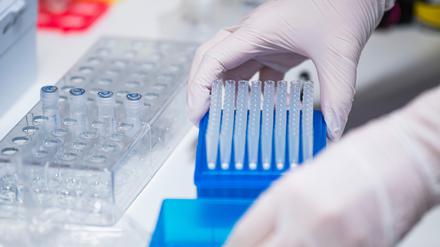 Ein Klinikverbund will Atemwegsviren künftig genau im Blick behalten und Patienten regelmäßig testen.