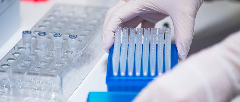 Ein Klinikverbund will Atemwegsviren künftig genau im Blick behalten und Patienten regelmäßig testen.