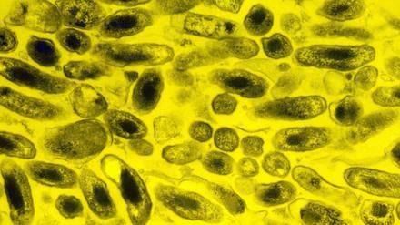 Das Bakterium Coxiella burnetti vermehrt sich gern im Inneren von Plazentazellen (hier gelb gefärbt), weshalb eine Infektion vor allem das Ungeborene gefährdet.