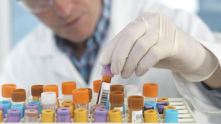 Manchmal wissen Unikliniken selber nicht, was aus Studien ihres eigenen Hauses wird.