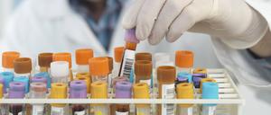 Manchmal wissen Unikliniken selber nicht, was aus Studien ihres eigenen Hauses wird.