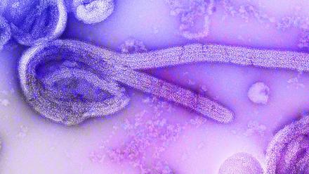 Eine elektronenmikroskopische Aufnahme des Marburgvirus. Ein Ausbruch des tödlichen Marburgvirus im zentralafrikanischen Äquatorialguinea weitet sich aus. 