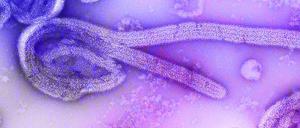 Eine elektronenmikroskopische Aufnahme des Marburgvirus. Ein Ausbruch des tödlichen Marburgvirus im zentralafrikanischen Äquatorialguinea weitet sich aus. 