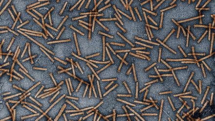 Von den Bakterien würden nur aufgereinigte Proteine verwendet, die diese elektronenmikroskopische Aufnahme zeigt. Die Mikroorganismen selbst kommen in keiner therapeutischen Situation zum Einsatz.