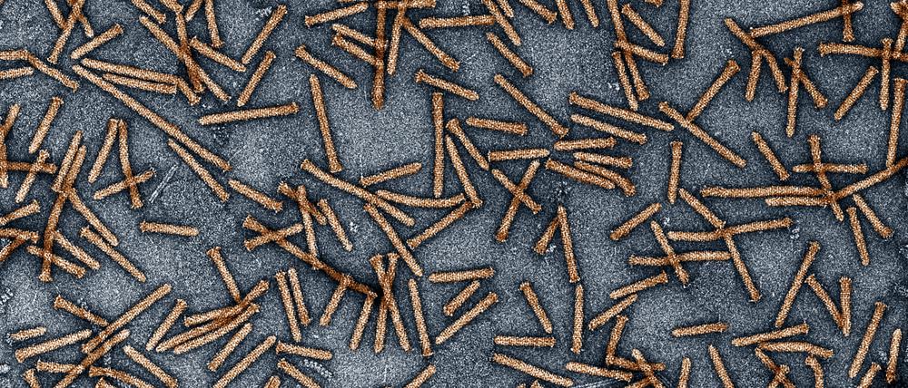 Von den Bakterien würden nur aufgereinigte Proteine verwendet, die diese elektronenmikroskopische Aufnahme zeigt. Die Mikroorganismen selbst kommen in keiner therapeutischen Situation zum Einsatz.