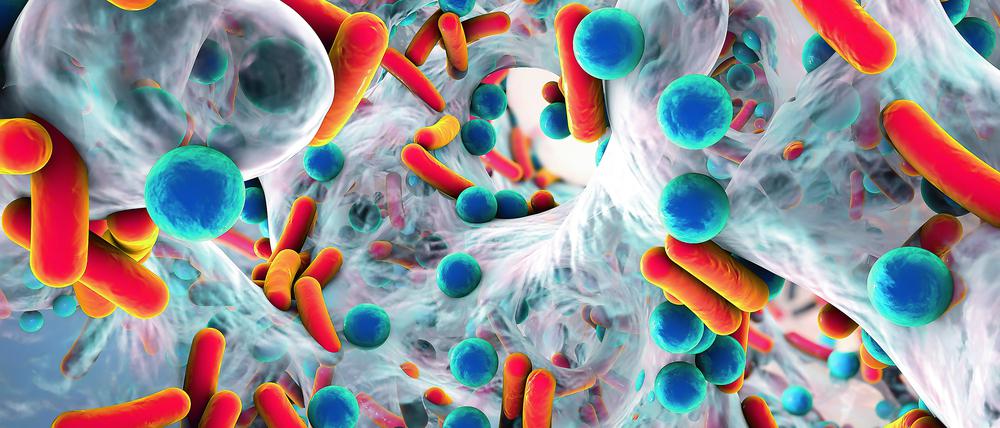 Bakterien können nicht nur akute Infektionen, sondern auch eine Sepsis auslösen. Grund ist eine überschießende Reaktion des Immunsystems.
