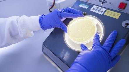 Krebsforschung ist aufwändig und kostspielig. Von Patenten auf neue Therapien profitieren Firmen mehr als öffentliche Institute, in denen sie entwickelt wurden. 