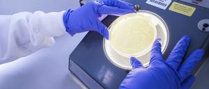 Krebsforschung ist aufwändig und kostspielig. Von Patenten auf neue Therapien profitieren Firmen mehr als öffentliche Institute, in denen sie entwickelt wurden. 