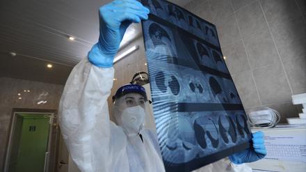 Eine Computertomografie dient der Diagnose von Covid-19, ist aber alleine nicht ausreichend