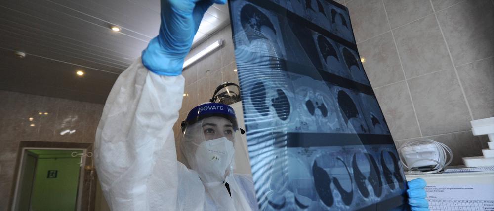 Eine Computertomografie dient der Diagnose von Covid-19, ist aber alleine nicht ausreichend