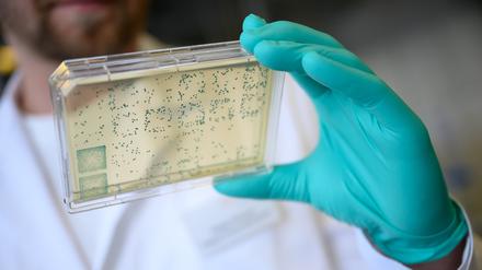Ein Laborant schaut sich einen Träger mit Bakterien an, aus denen DNA und anschließend RNA gewonnen wird.