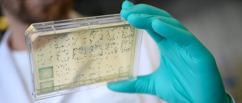 Ein Laborant schaut sich einen Träger mit Bakterien an, aus denen DNA und anschließend RNA gewonnen wird.