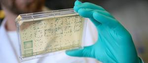 Ein Laborant schaut sich einen Träger mit Bakterien an, aus denen DNA und anschließend RNA gewonnen wird.