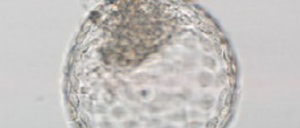 Ein aus Javaneraffen-Stammzellen hergestelltes Embryoid.