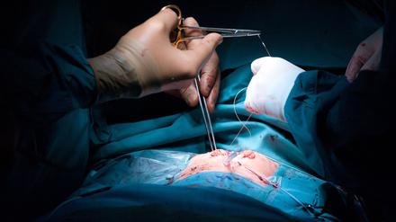 Die Operation am Herzen verlangt viel Fingerspitzengefühl, egal ob die OP bei offenem Brustkorb stattfindet oder per Katheter.
