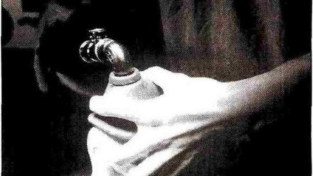 Narkose ist in der Regel gut begründet.