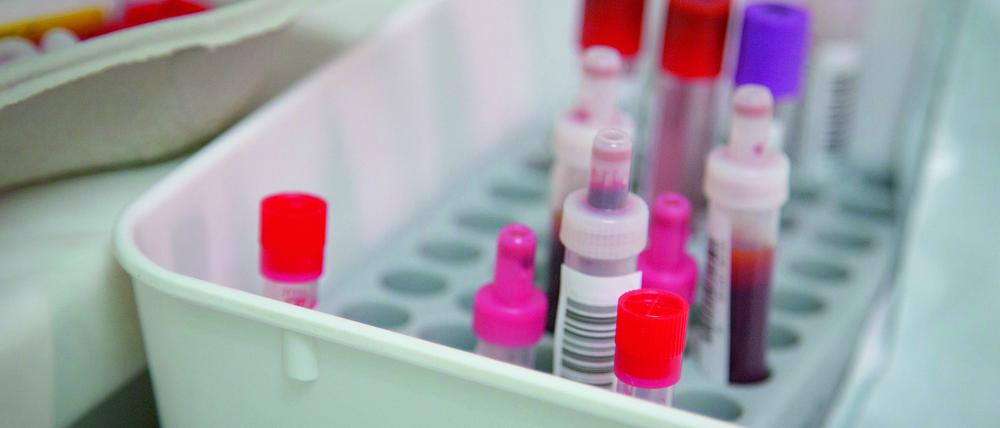 An den Blutproben von 111 Patient:innen wurden die Immunfunktionen bestimmt.