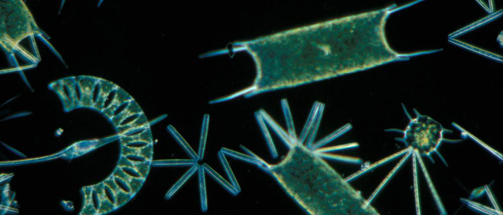 Ob pflanzlich, wie hier, pilzartig oder tierisch: Alle Zellen höherer Lebewesen entstanden aus „Eukaryoten“, Zellen mit Zellkern, die sich erst zwei Milliarden Jahre nach Entstehung des Lebens entwickelten. 