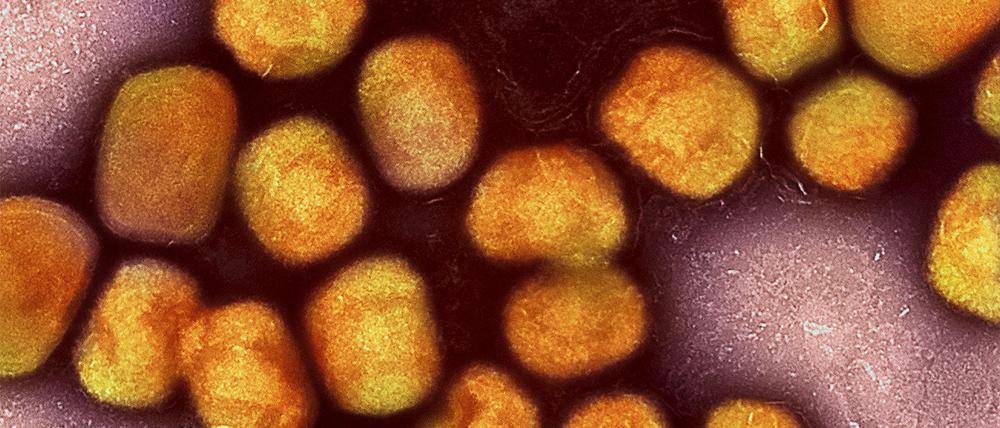 Eine kolorierte transmissionselektronenmikroskopische Aufnahme von Partikeln des Affenpockenvirus (Gold), kultiviert und gereinigt aus einer Zellkultur, aufgenommen in der NIAID Integrated Research Facility